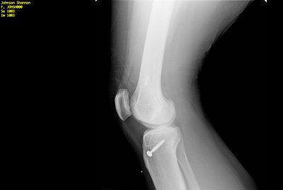 xray