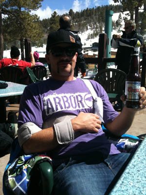 30-min-after-the-dislocation